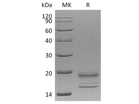 Recombinant Human IL-17A&IL-17F Heterodimer Protein (His Tag) - ABMIUM