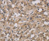 Anti-Human/Mouse/Rat DCN Antibody - ABMIUM