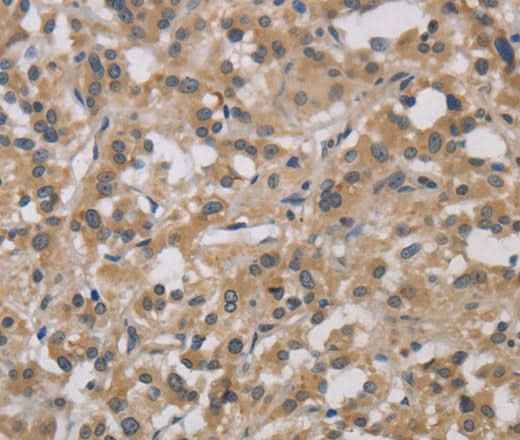 Anti-Human/Mouse/Rat DCN Antibody