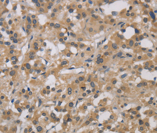 Anti-Human/Mouse/Rat DCN Antibody - ABMIUM