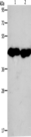 Anti-Human/Mouse/Rat CKM Antibody - ABMIUM