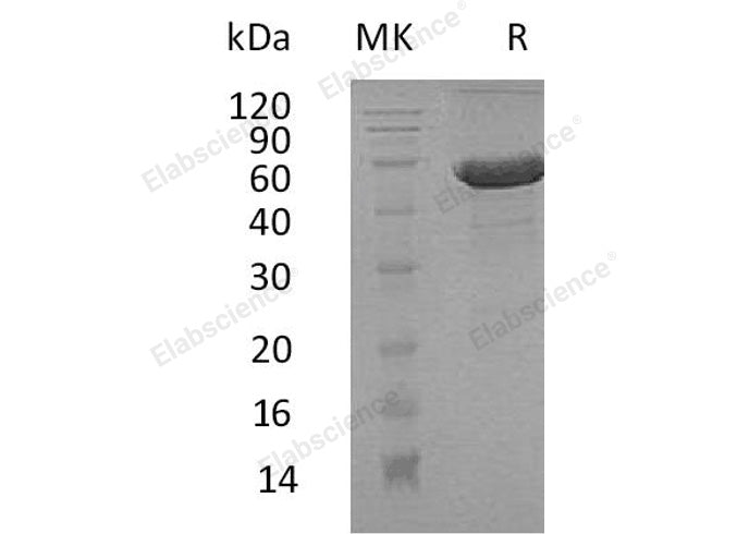 Recombinant Human Dermatopontin/DPT Protein (Fc & His Tag) - ABMIUM