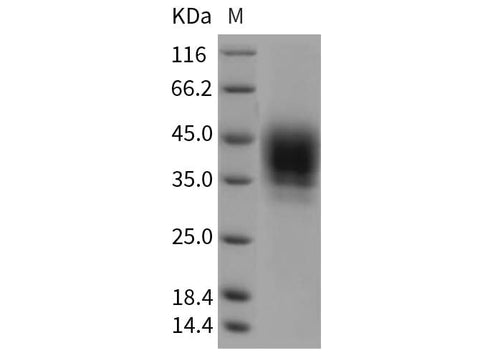 Recombinant Rat CD48 Protein (Fc Tag) - ABMIUM