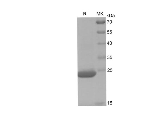 SDS-PAGE analysis of Human CDC42 proteins, 2 μg/lane of Recombinant Human CDC42 proteins was resolved with SDS-PAGE under reducing conditions, showing bands at 24 kDa.