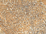 Immunohistochemistry of paraffin-embedded Human tonsil tissue using GSG1L Polyclonal Antibody at dilution of 1:50(×200)