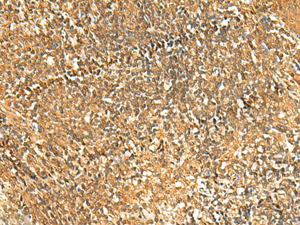 Immunohistochemistry of paraffin-embedded Human tonsil tissue using GSG1L Polyclonal Antibody at dilution of 1:50(×200)
