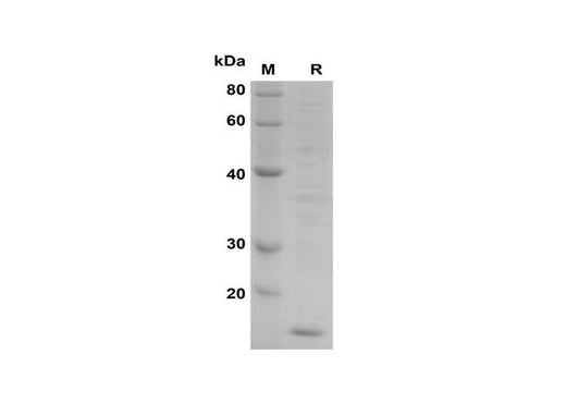 SDS-PAGE analysis of Monkeypox virus A33R proteins, 2 μg/lane of Recombinant Monkeypox virus A33R proteins was resolved with SDS-PAGE under reducing conditions, showing bands at 16 kDa.