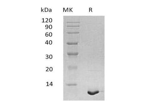 Recombinant Human S100A12/CAGC Protein - ABMIUM