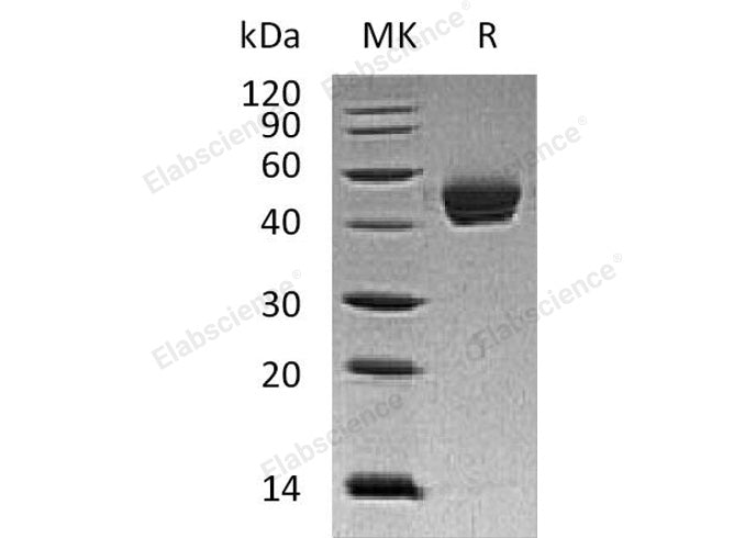 Recombinant Human Dipeptidase 1/DPEP1 Protein (His Tag) - ABMIUM