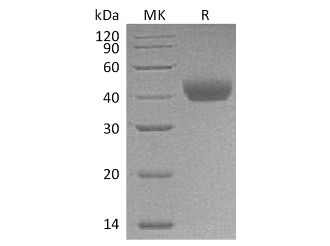 Recombinant Rat CD38 Protein (His Tag) - ABMIUM