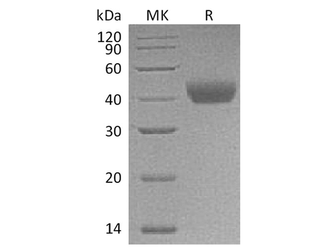 Recombinant Rat CD38 Protein (His Tag) - ABMIUM