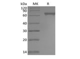 Recombinant Human Notch2 (C-6His) - ABMIUM