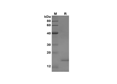 Recombinant Mouse TNF-α Protein(His Tag) - ABMIUM
