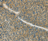 Anti-Human/Mouse/Rat GJC1 Antibody - ABMIUM