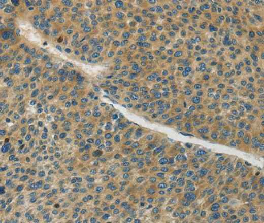 Anti-Human/Mouse/Rat GJC1 Antibody