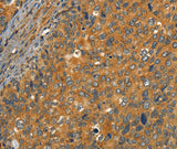 Anti-Human/Mouse/Rat CIB1 Antibody - ABMIUM