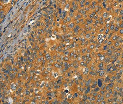 Anti-Human/Mouse/Rat CIB1 Antibody