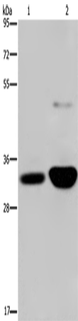 Anti-Human/Mouse/Rat MAPRE3 Antibody - ABMIUM