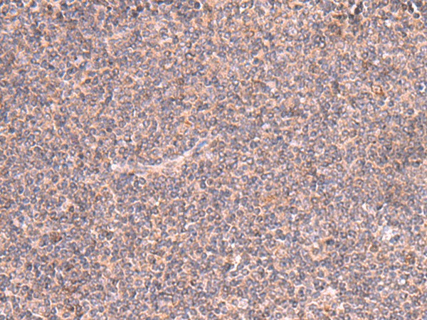 Immunohistochemistry of paraffin-embedded Human tonsil tissue using MRPS24 Polyclonal Antibody at dilution of 1:90(×200)