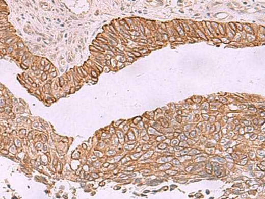 Anti-Human/Rat KCNK12 Antibody