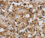 Anti-Human/Mouse E2F4 Antibody - ABMIUM