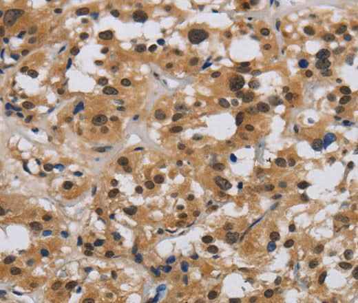 Anti-Human/Mouse E2F4 Antibody