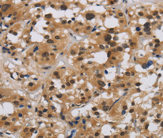 Anti-Human/Mouse E2F4 Antibody - ABMIUM