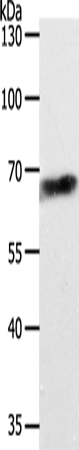 Anti-Human/Mouse ABCD4 Antibody - ABMIUM