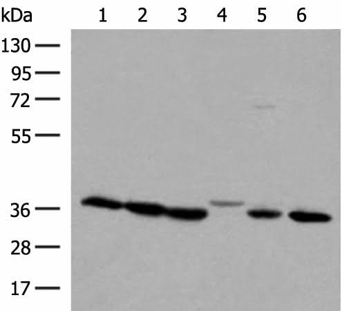 Western blot analysis of 293T and A375 cell lysates using LDHA Polyclonal Antibody at dilution of 1:250