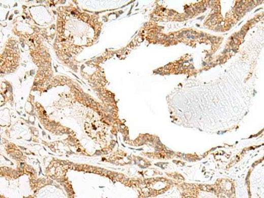 Anti-Human/Mouse ENAH Antibody