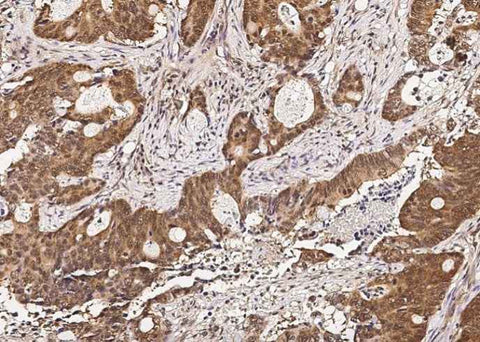 Anti-Human RUVBL1 Antibody [A930] - ABMIUM