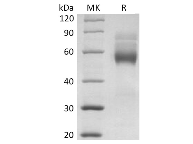 Recombinant Human HVEM/TNFRSF14 Protein (mFc Tag) - ABMIUM