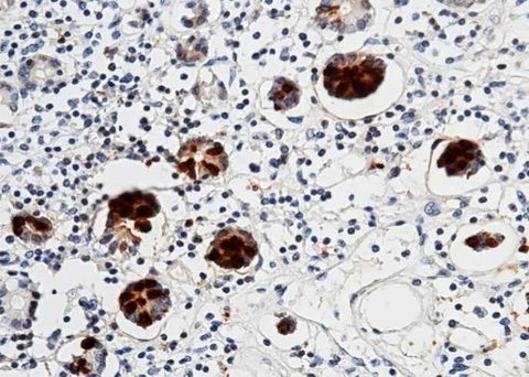 Anti-Human REG3A Antibody [A1227] - ABMIUM