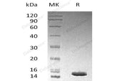 Recombinant Human LAMTOR3/MP1 Protein (His Tag) - ABMIUM