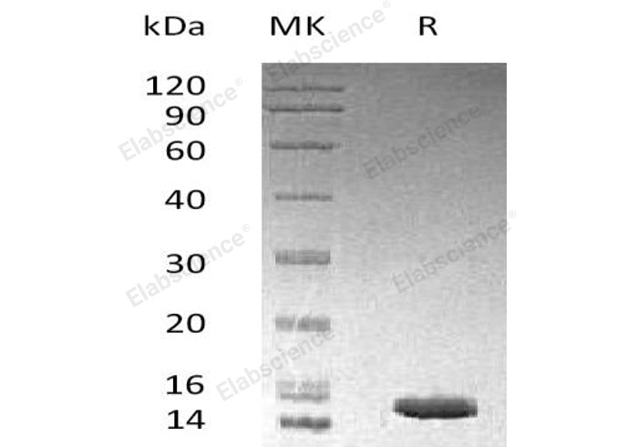 Recombinant Human LAMTOR3/MP1 Protein (His Tag) - ABMIUM