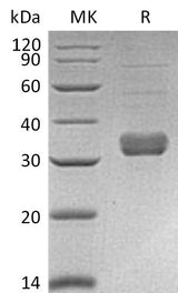 Recombinant Mouse Collectin-11/COLEC11 Protein (Human Cells, His Tag) - ABMIUM