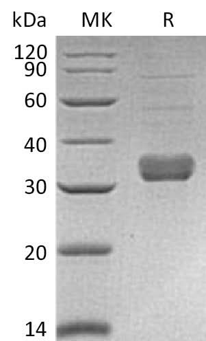 Recombinant Mouse Collectin-11/COLEC11 Protein (Human Cells, His Tag) - ABMIUM