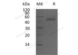Recombinant Human PSG5 Protein (His Tag) - ABMIUM