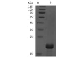 SDS-PAGE analysis of Human TRAPPC6A/TPC6A proteins, 2 μg/lane of Recombinant Human TRAPPC6A/TPC6A proteins was resolved with SDS-PAGE under reducing conditions, showing bands at 20 kDa.