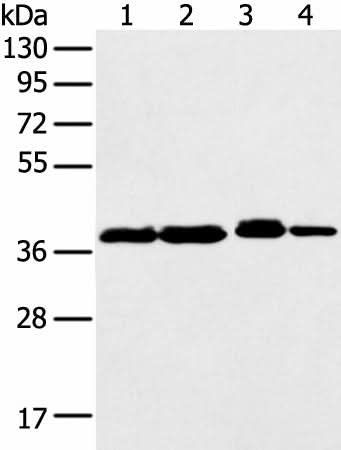 Western blot analysis of 293T K562 Jurkat cell using DCX Polyclonal Antibody at dilution of 1:500