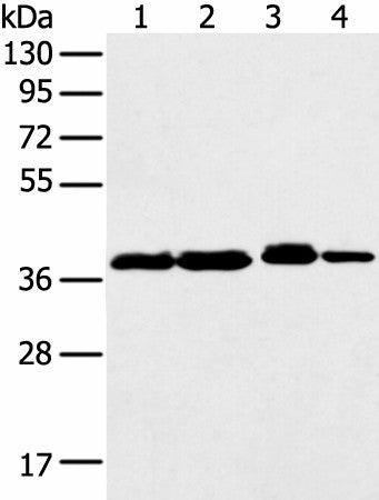 Western blot analysis of 293T K562 Jurkat cell using DCX Polyclonal Antibody at dilution of 1:500