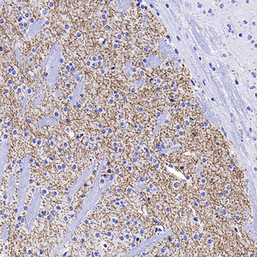 Immunohistochemistry analysis of paraffin-embedded mouse striatum using TH Monoclonal Antibody at dilution of 1:1000.