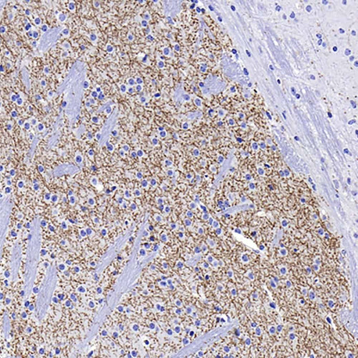 Immunohistochemistry analysis of paraffin-embedded mouse striatum using TH Monoclonal Antibody at dilution of 1:1000.