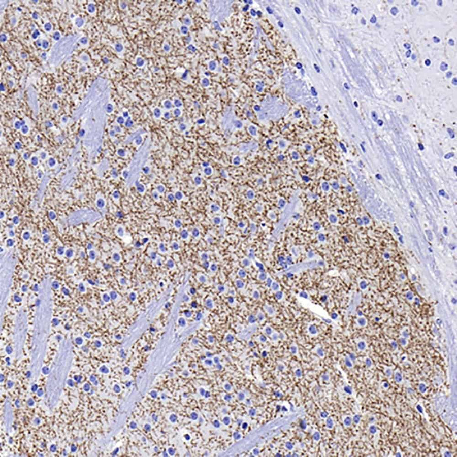 Immunohistochemistry analysis of paraffin-embedded mouse striatum using TH Monoclonal Antibody at dilution of 1:1000.