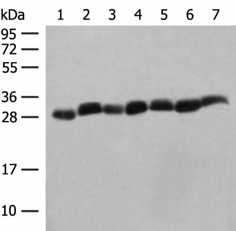 Western blot analysis of Hela cell Mouse spleen tissue Mouse liver tissue PC3 cell HL60 cell A549 cell NIH/3T3 cell lysates using PSMA3 Polyclonal Antibody at dilution of 1:350