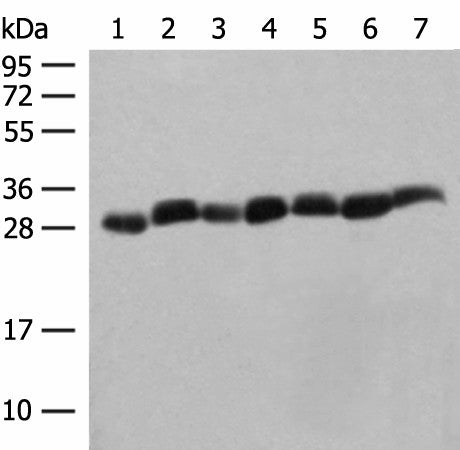 Western blot analysis of Hela cell Mouse spleen tissue Mouse liver tissue PC3 cell HL60 cell A549 cell NIH/3T3 cell lysates using PSMA3 Polyclonal Antibody at dilution of 1:350