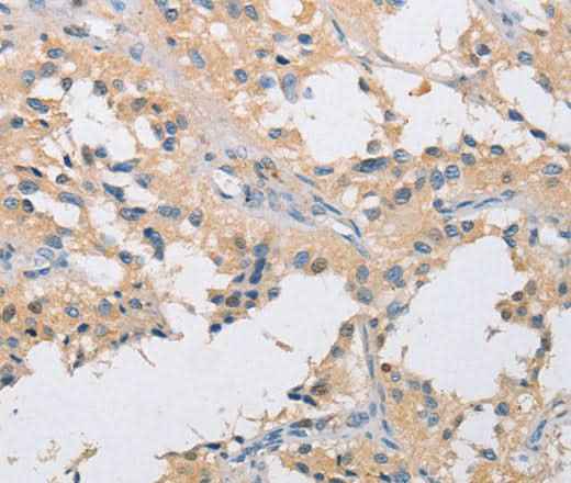 Anti-Human/Mouse/Rat IKK gamma Antibody