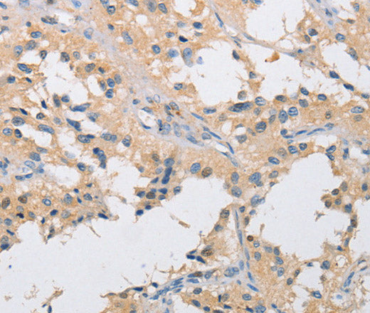 Anti-Human/Mouse/Rat IKK gamma Antibody - ABMIUM