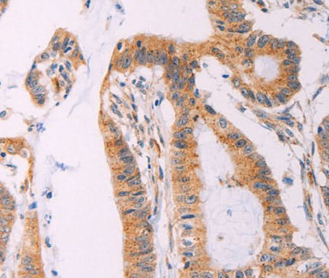 Anti-Human ADCY1 Antibody - ABMIUM