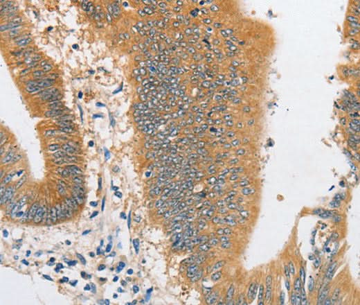 Anti-Human/Mouse ARHGAP5 Antibody - ABMIUM